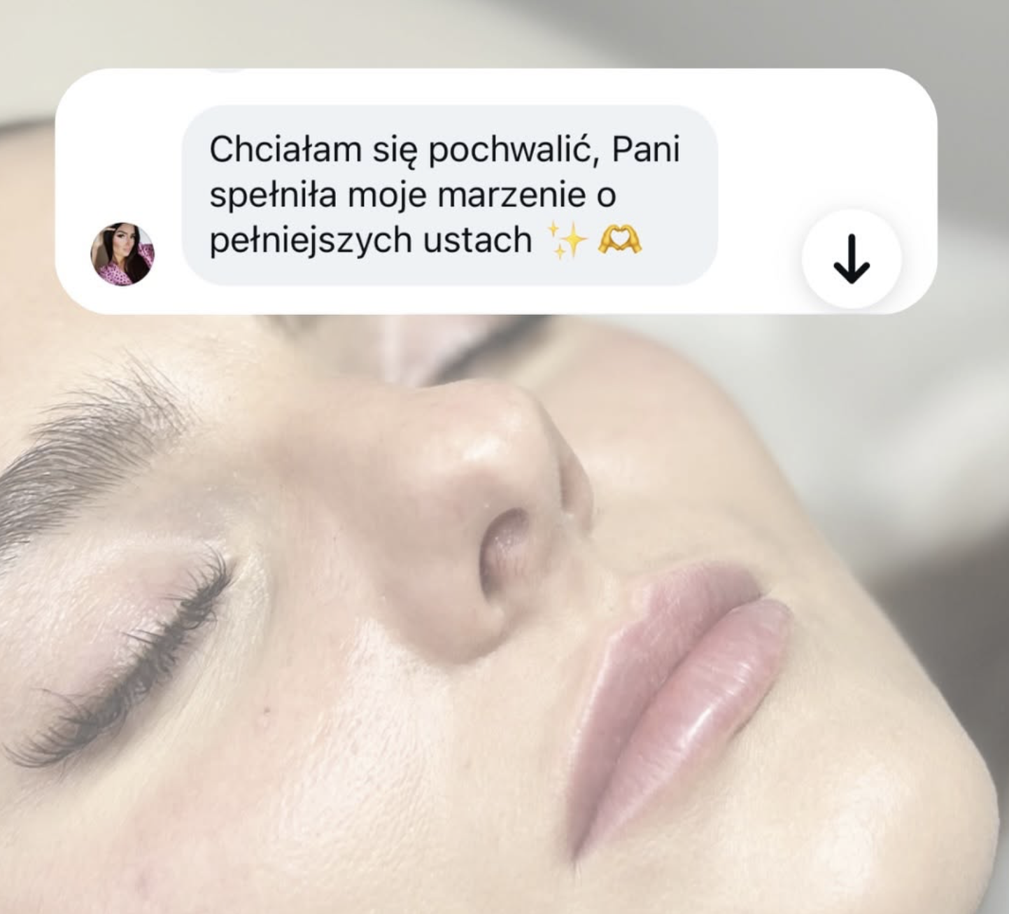 Opinia klientki Hello Skin po zabiegu